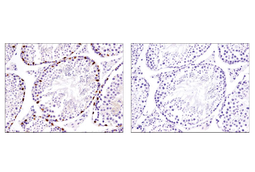 Immunohistochemistry Image 7: Sox9 (D8G8H) Rabbit mAb