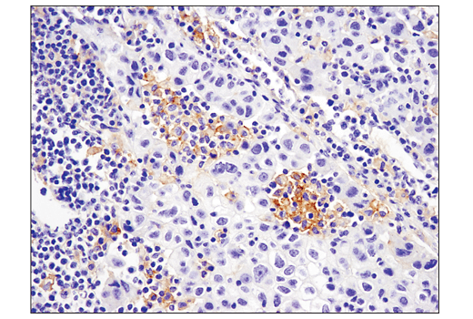 Immunohistochemistry Image 1: PD-L2 (D7U8C™) XP® Rabbit mAb