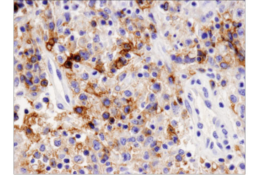 Immunohistochemistry Image 4: PD-L2 (D7U8C™) XP® Rabbit mAb