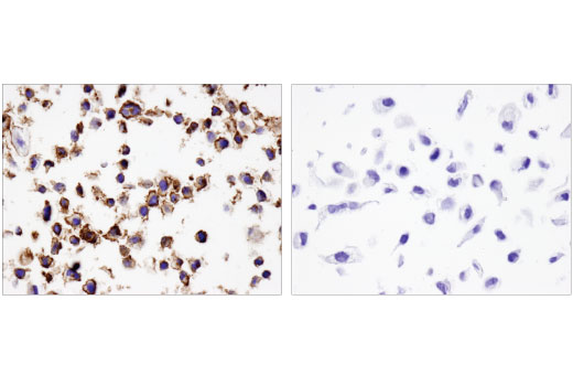 Immunohistochemistry Image 5: PD-L2 (D7U8C™) XP® Rabbit mAb