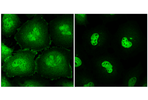 Immunofluorescence Image 1: Stat3 (124H6) Mouse mAb (BSA and Azide Free)