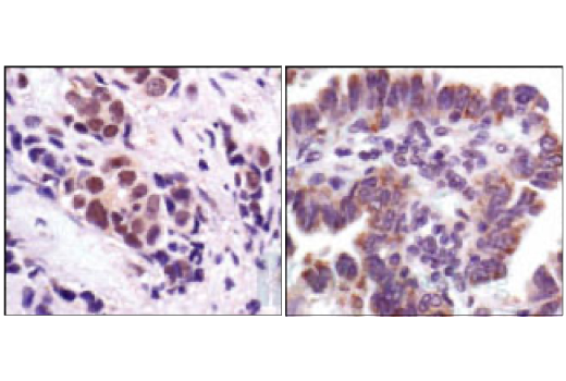 Immunohistochemistry Image 1: Stat3 (124H6) Mouse mAb (BSA and Azide Free)