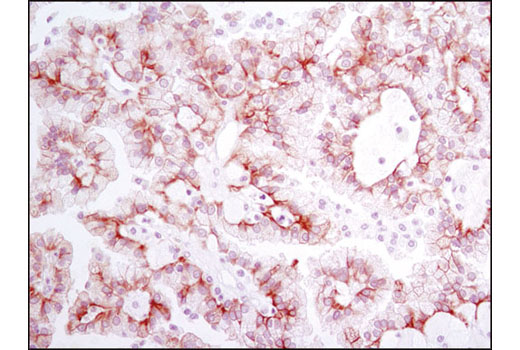 Immunohistochemistry Image 3: Met (D1C2) XP® Rabbit mAb (BSA and Azide Free)