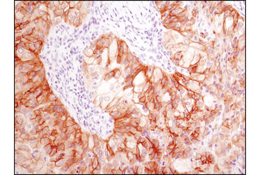 Immunohistochemistry Image 4: Met (D1C2) XP® Rabbit mAb (BSA and Azide Free)