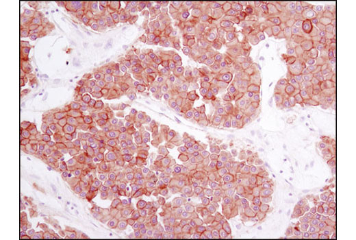 Immunohistochemistry Image 6: Met (D1C2) XP® Rabbit mAb (BSA and Azide Free)