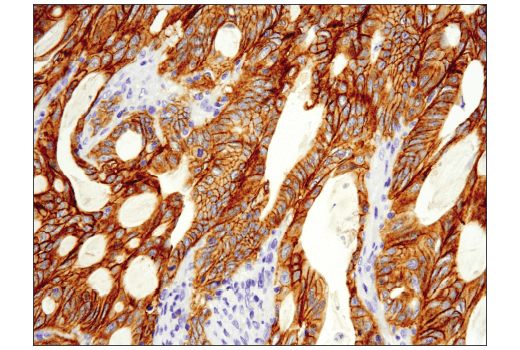 Immunohistochemistry Image 2: Met (D1C2) XP® Rabbit mAb (BSA and Azide Free)