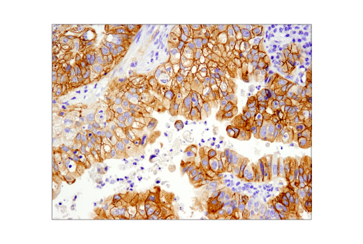 Immunohistochemistry Image 1: Met (D1C2) XP® Rabbit mAb (BSA and Azide Free)