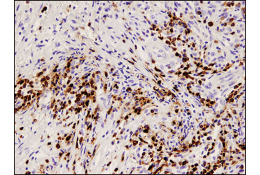 Immunohistochemistry Image 3: CD79A (D1X5C) XP® Rabbit mAb (BSA and Azide Free)