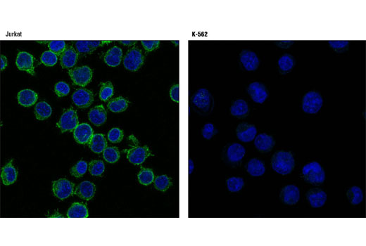 Image 21: Microglia LPS-Related Module Antibody Sampler Kit