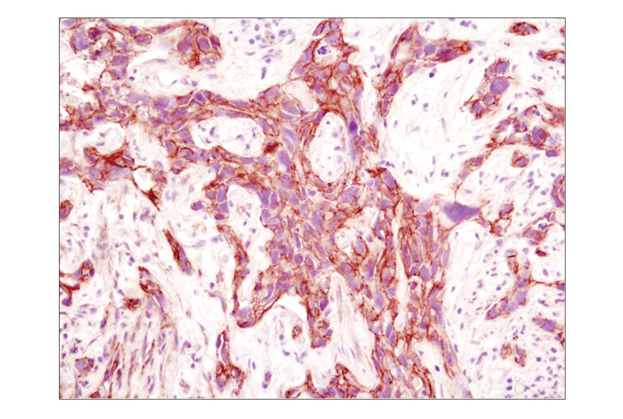 Immunohistochemistry Image 8: β-Catenin (D10A8) XP® Rabbit mAb