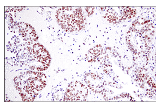 Immunohistochemistry Image 2: EED (E4L6E) XP® Rabbit mAb