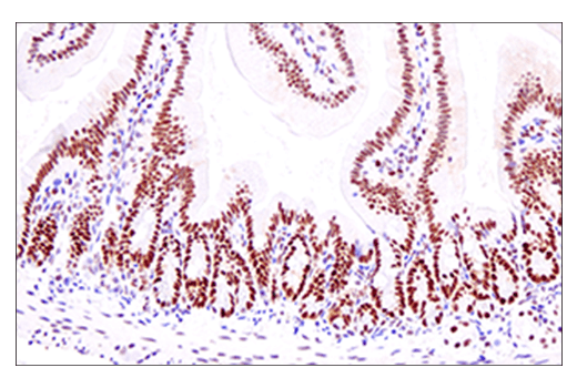 Immunohistochemistry Image 6: EED (E4L6E) XP® Rabbit mAb