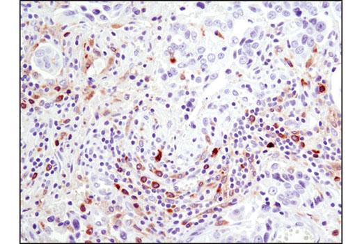  Image 37: B Cell Signaling Antibody Sampler Kit II