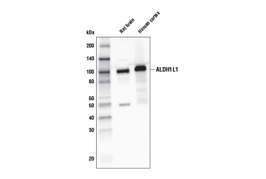 Western Blotting Image 1: ALDH1L1 (E7I2Q) Rabbit mAb