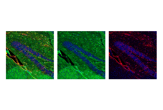 Immunofluorescence Image 2: ALDH1L1 (E7I2Q) Rabbit mAb