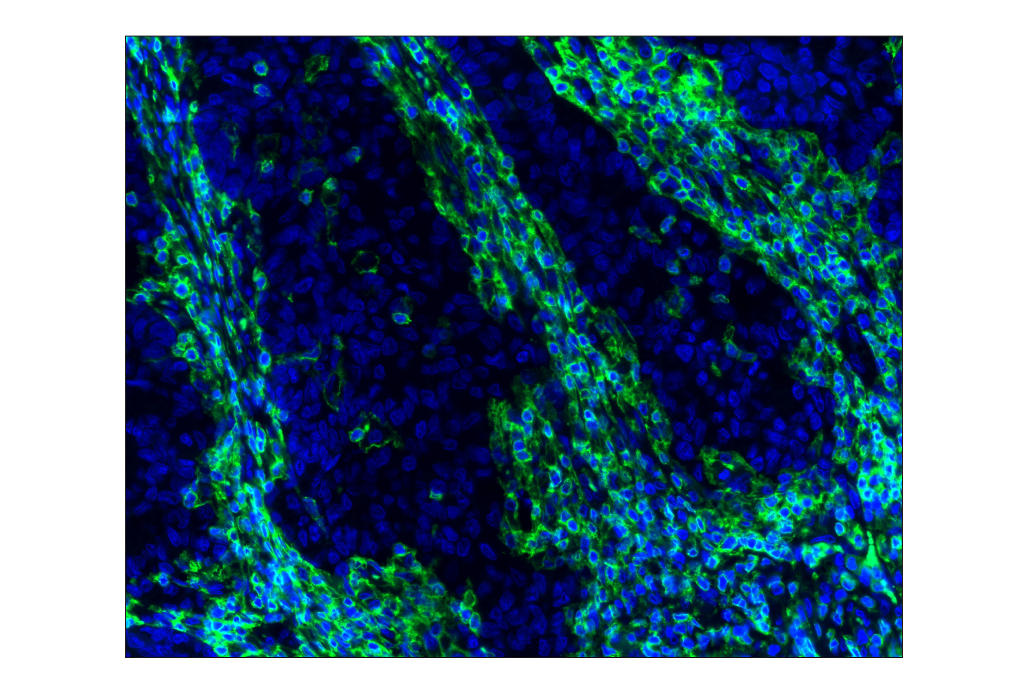 Immunohistochemistry Image 1: CD45 (Intracellular Domain) (D9M8I) XP® Rabbit mAb (Alexa Fluor® 488 Conjugate)