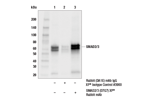  Image 20: TGF-β Fibrosis Pathway Antibody Sampler Kit