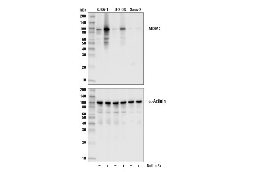 Western Blotting Image 1: MDM2 (D1V2Z) Rabbit mAb