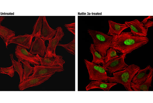  Image 15: PROTAC E3 Ligase Profiling Antibody Sampler Kit