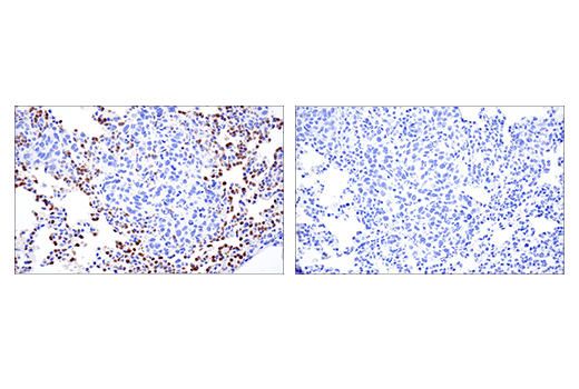 Immunohistochemistry Image 3: Ly-6G (E6Z1T) Rabbit mAb