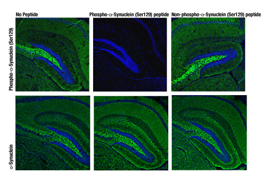 Immunofluorescence Image 1: Phospho-α-Synuclein (Ser129) (D1R1R) Rabbit mAb (BSA and Azide Free)