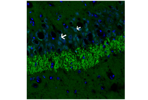 Immunofluorescence Image 2: Phospho-α-Synuclein (Ser129) (D1R1R) Rabbit mAb (BSA and Azide Free)