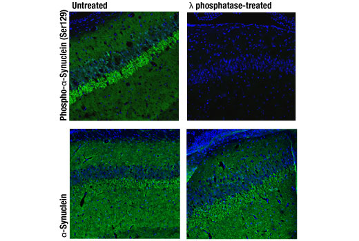 Immunofluorescence Image 3: Phospho-α-Synuclein (Ser129) (D1R1R) Rabbit mAb (BSA and Azide Free)