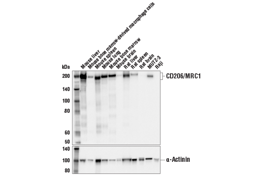 Western Blotting Image 1: CD206/MRC1 (E6T5J) XP® Rabbit mAb (BSA and Azide Free)