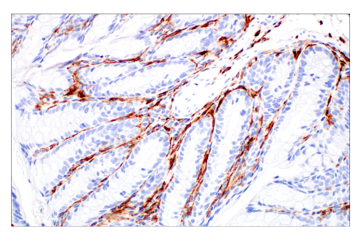 Immunohistochemistry Image 8: CD206/MRC1 (E6T5J) XP® Rabbit mAb (BSA and Azide Free)