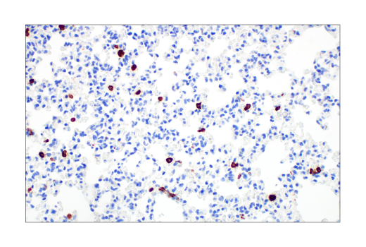 Immunohistochemistry Image 2: CD206/MRC1 (E6T5J) XP® Rabbit mAb (BSA and Azide Free)