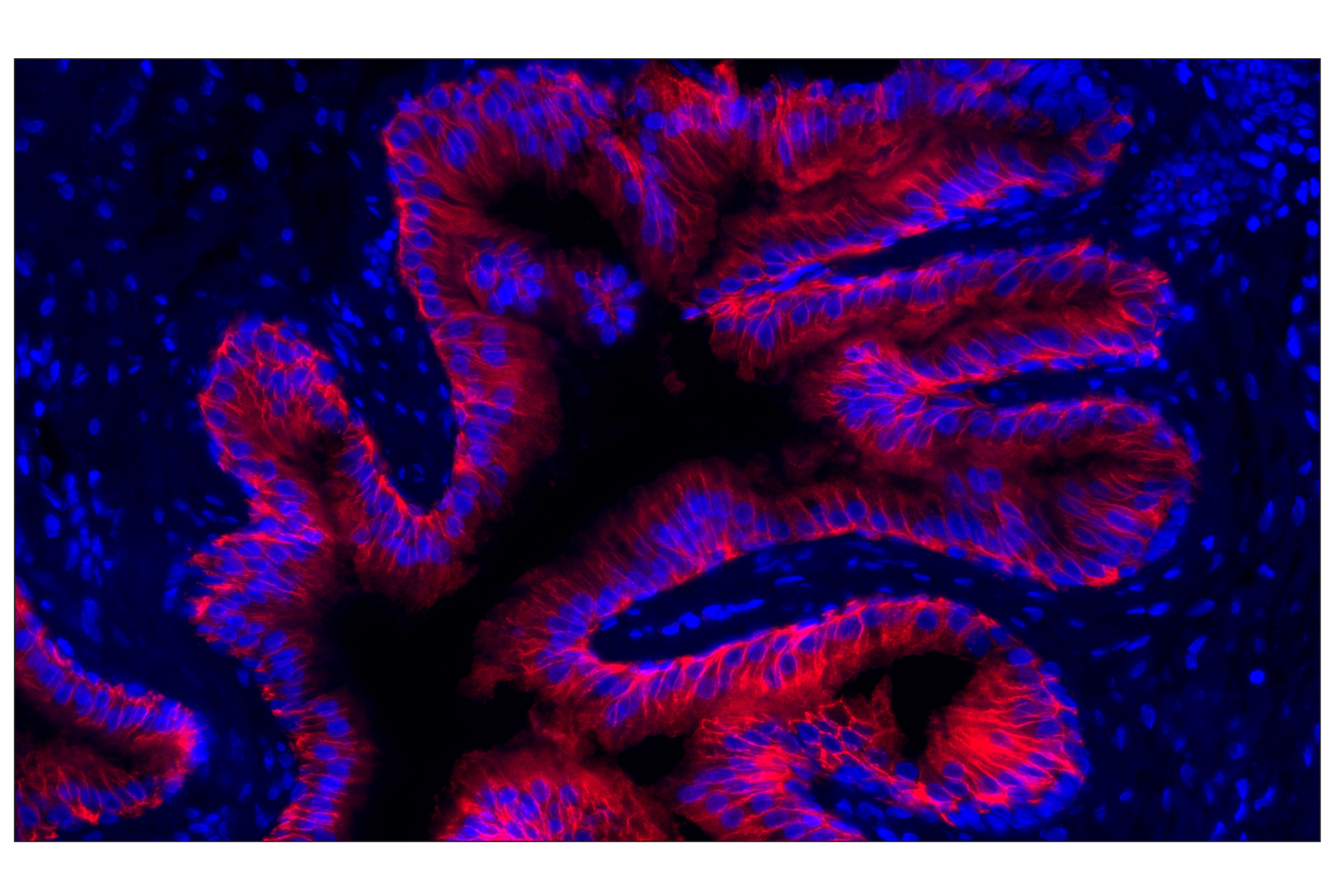 Immunohistochemistry Image 1: CD38 (E7Z8C) XP® Rabbit mAb (Alexa Fluor® 647 Conjugate)