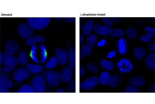  Image 11: Aurora A/B Substrate Antibody Sampler Kit