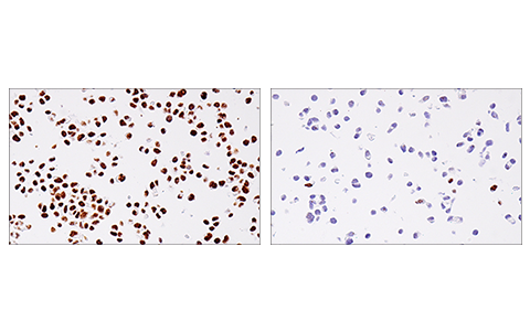 Immunohistochemistry Image 1: 53BP1 (E7N5D) XP® Rabbit mAb