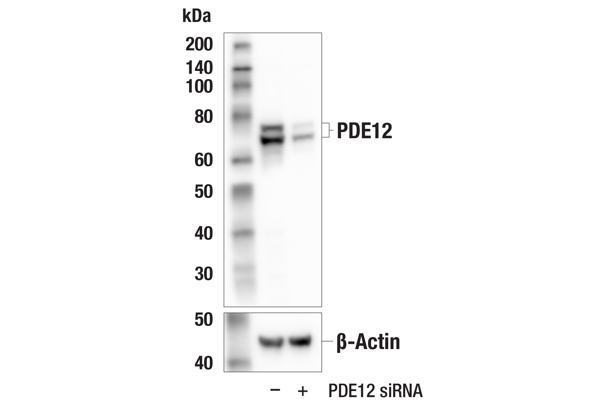  Image 17: OAS/RNase L Pathway Antibody Sampler Kit