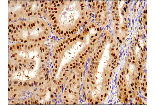  Image 52: Human Reactive Cell Death and Autophagy Antibody Sampler Kit