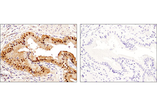  Image 58: Human Reactive Cell Death and Autophagy Antibody Sampler Kit