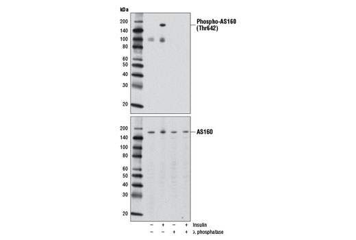  Image 11: AS160 Signaling Antibody Sampler Kit