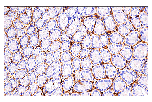 Immunohistochemistry Image 9: NCAM1 (CD56) (E7X9M) XP® Rabbit mAb (BSA and Azide Free)