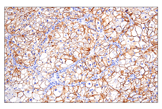 Immunohistochemistry Image 4: NCAM1 (CD56) (E7X9M) XP® Rabbit mAb (BSA and Azide Free)