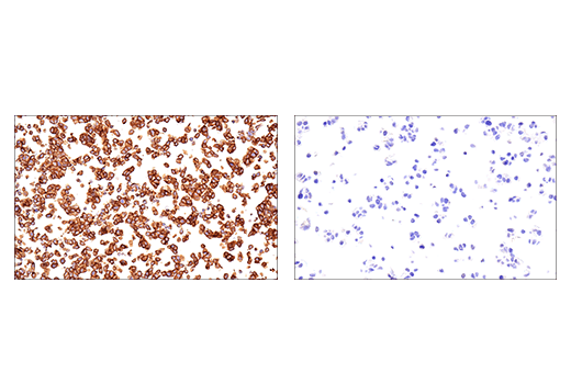 Immunohistochemistry Image 12: NCAM1 (CD56) (E7X9M) XP® Rabbit mAb (BSA and Azide Free)