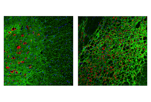 Immunofluorescence Image 1: NCAM1 (CD56) (E7X9M) XP® Rabbit mAb (BSA and Azide Free)