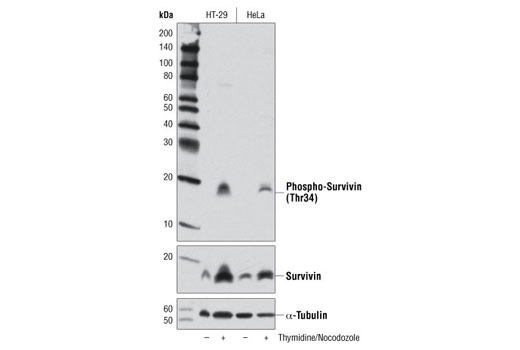 Western Blotting Image 1: Phospho-Survivin (Thr34) (D2E11) Rabbit mAb