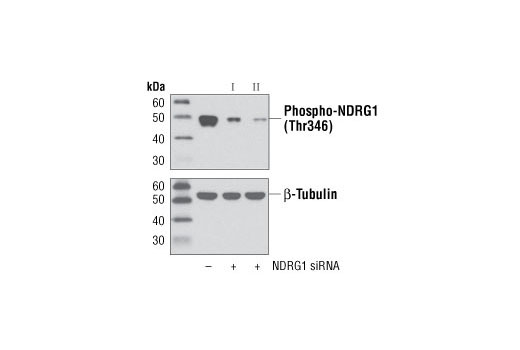 Western Blotting Image 1: Phospho-NDRG1 (Thr346) (D98G11) XP® Rabbit mAb (BSA and Azide Free)