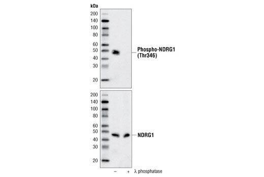 Western Blotting Image 2: Phospho-NDRG1 (Thr346) (D98G11) XP® Rabbit mAb (BSA and Azide Free)