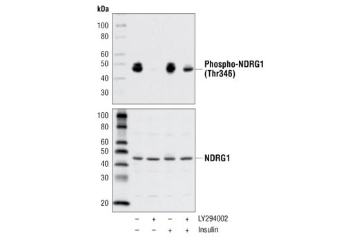 Western Blotting Image 3: Phospho-NDRG1 (Thr346) (D98G11) XP® Rabbit mAb (BSA and Azide Free)