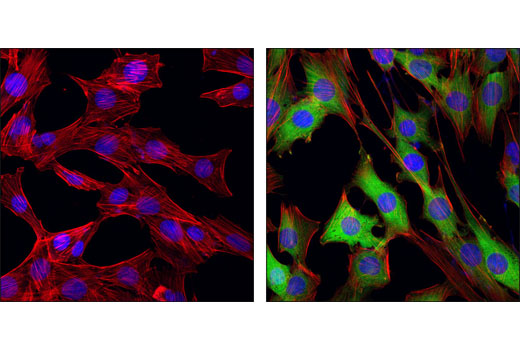 Immunofluorescence Image 2: Phospho-NDRG1 (Thr346) (D98G11) XP® Rabbit mAb (BSA and Azide Free)