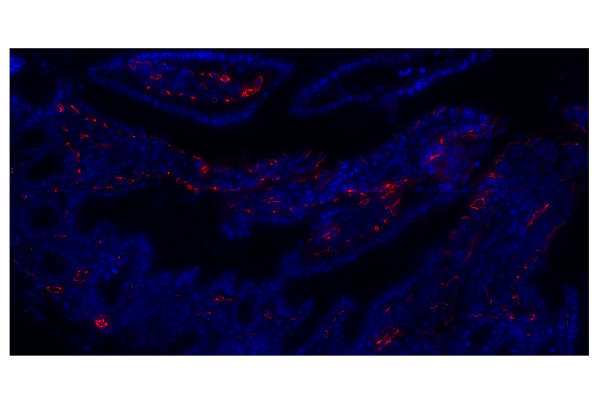 Immunohistochemistry Image 1: CD31 (PECAM-1) (D8V9E) XP® Rabbit mAb (Alexa Fluor® 555 Conjugate)