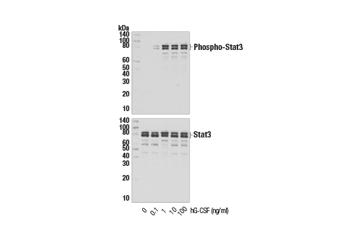  Image 3: Human Granulocyte Colony Stimulating Factor (hG-CSF)