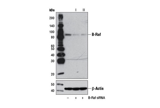  Image 1: SignalSilence® B-Raf siRNA I