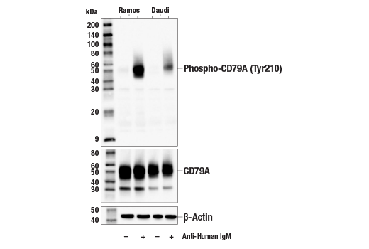 Western Blotting Image 1: Phospho-CD79A (Tyr210) (E8E9Z) Rabbit mAb